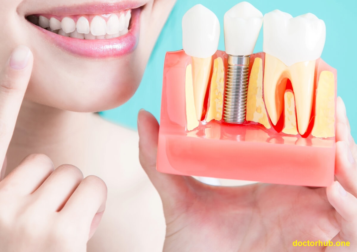 A Permanent Solution for a Confident Smile