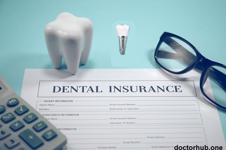 Does Dental Insurance Cover Implants | Here’s What You Need to Know