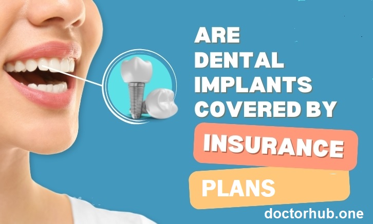 How Dental Insurance Can Help You Save on Implant Costs