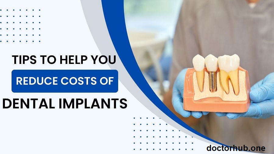 Smart Ways to Save on Dental Implants Without Compromising Quality